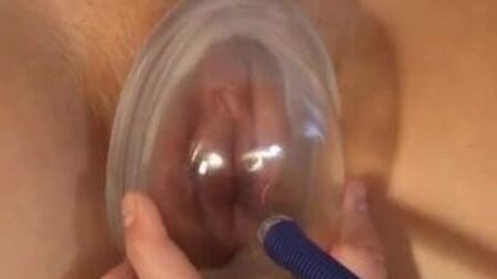 Pompe vaginale