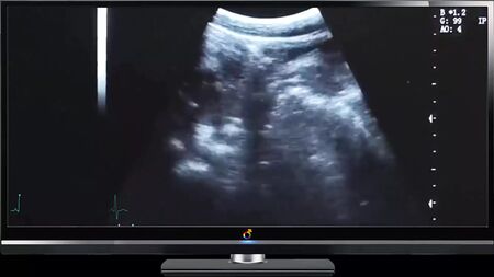 Papa : Baise profonde à l'échographie