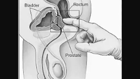 Comment se faire un massage de la prostate soi-même